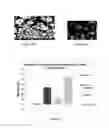 Fig. 08 - Microneedle-based transdermal delivery system and method of making same