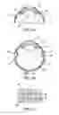 Fig. 03 - OPHTHALMIC DRUG DELIVERY METHOD
