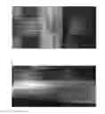 Fig. 07 - Devices and methods for injectable vascular sclerofoams using a carrier matrix and uses thereof