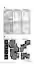 Fig. 03 - Method of encapsulating pancreatic islet cells introduced to siRNA against PHLDA3