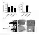 Fig. 02 - COMPOSITION USING METFORMIN FOR PREVENTING OR TREATING IMMUNE DISEASES INCLUDING LUPUS