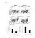 Fig. 03 - COMPOSITION USING METFORMIN FOR PREVENTING OR TREATING IMMUNE DISEASES INCLUDING LUPUS