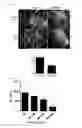 Fig. 04 - COMPOSITION USING METFORMIN FOR PREVENTING OR TREATING IMMUNE DISEASES INCLUDING LUPUS