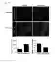Fig. 08 - COMPOSITION USING METFORMIN FOR PREVENTING OR TREATING IMMUNE DISEASES INCLUDING LUPUS