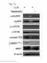 Fig. 13 - COMPOSITION USING METFORMIN FOR PREVENTING OR TREATING IMMUNE DISEASES INCLUDING LUPUS