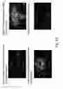 Fig. 28 - Peptide and small molecule agonists of EPHA and uses thereof