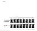 Fig. 02 - Use of composition for modulating angiogenesis