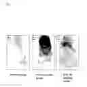 Fig. 08 - Use of composition for modulating angiogenesis