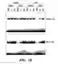 Fig. 16 - HIF inhibitors and use thereof