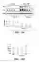 Fig. 30 - HIF inhibitors and use thereof