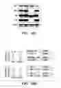 Fig. 32 - HIF inhibitors and use thereof