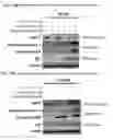 Fig. 26 - Method of treating leukemia using pharmaceutical formulation containing thienotriazolodiazepine compounds