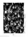 Fig. 06 - Surface-reacted calcium carbonate for desensitizing teeth