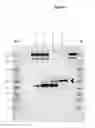 Fig. 06 - Oncolytic virus for expression of immune checkpoint modulators