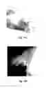 Fig. 16 - Plant extract composition for reducing topical fat and promoting weight loss as well as applications thereof
