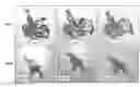 Fig. 01 - Treating liver diseases