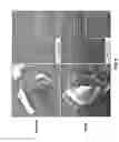 Fig. 07 - Treating liver diseases