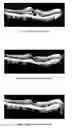 Fig. 10 - METHOD OF TREATING CONDITIONS OF THE EYE WITH AN ANTI-VEGF DARPIN