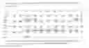 Fig. 04 - Immunogenic Polypeptide Composed of HLA-B7 Restricted Tumor Antigen-Derived Optimized Cryptic Peptides, and Uses Thereof