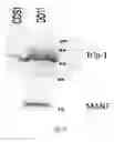 Fig. 10 - MANF as a Regulator of Immune System Function