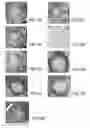 Fig. 19 - Compositions and methods for reducing overdose