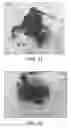 Fig. 27 - Compositions and methods for reducing overdose