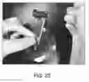 Fig. 28 - Compositions and methods for reducing overdose