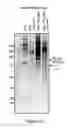 Fig. 04 - FACTOR VIII POLYMER CONJUGATES