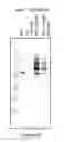 Fig. 08 - FACTOR VIII POLYMER CONJUGATES