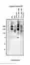 Fig. 11 - FACTOR VIII POLYMER CONJUGATES