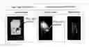 Fig. 05 - Articular cartilage imaging composition