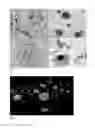 Fig. 02 - Compounds binding to neuropathological aggregates