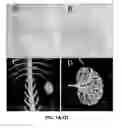 Fig. 08 - In situ solidifying complex coacervates and methods of making and using thereof