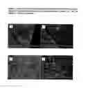 Fig. 08 - Acellular bioabsorbable tissue regeneration matrices