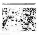 Fig. 43 - Acellular bioabsorbable tissue regeneration matrices