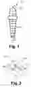 Fig. 02 - COMPOSITE PART FOR ENDOSSEOUS IMPLANTATION AND METHOD FOR MANUFACTURING SAME