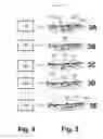 Fig. 03 - COMPOSITE PART FOR ENDOSSEOUS IMPLANTATION AND METHOD FOR MANUFACTURING SAME