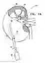 Fig. 02 - OPTIMIZATION OF ALGINATE ENCAPSULATION OF ISLETS FOR TRANSPLANTATION