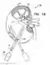 Fig. 03 - OPTIMIZATION OF ALGINATE ENCAPSULATION OF ISLETS FOR TRANSPLANTATION