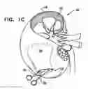 Fig. 04 - OPTIMIZATION OF ALGINATE ENCAPSULATION OF ISLETS FOR TRANSPLANTATION