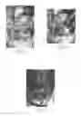 Fig. 06 - Fixation devices for tissue repair