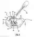 Fig. 07 - VAD integrated flow sensor