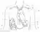 Fig. 01 - Low cost ventricular device and system thereof