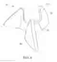 Fig. 05 - Low cost ventricular device and system thereof