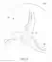 Fig. 07 - Low cost ventricular device and system thereof