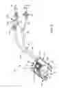 Fig. 04 - Cassette for a surgical fluid management pump system