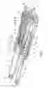 Fig. 02 - Drug delivery device