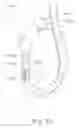 Fig. 17 - Mask system with snap-fit shroud