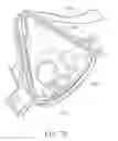 Fig. 32 - Mask system with snap-fit shroud