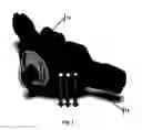 Fig. 02 - Apparatus, systems, and methods for treating obstructive sleep apnea